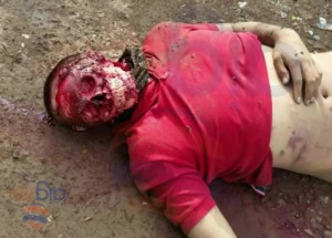 Ayotzinapa Student Had His Face Removed 